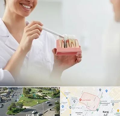 دکتر دندانساز در شاهین ویلا کرج