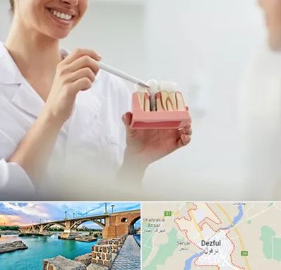 دکتر دندانساز در دزفول