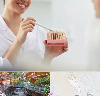 دکتر دندانساز در درکه