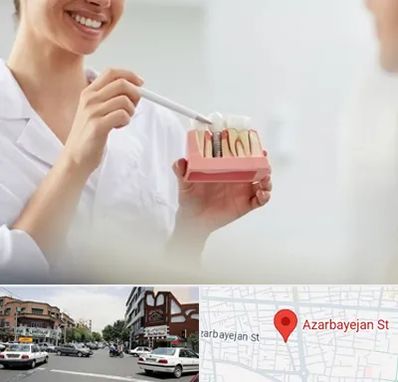 دکتر دندانساز در خیابان آذربایجان