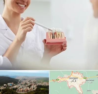 دکتر دندانساز در گرگان