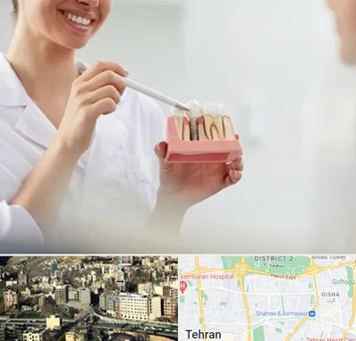 دکتر دندانساز در مرزداران 