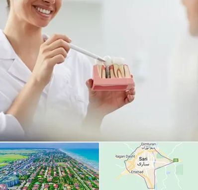 دکتر دندانساز در ساری