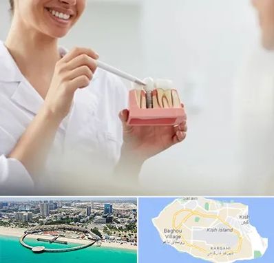 دکتر دندانساز در کیش