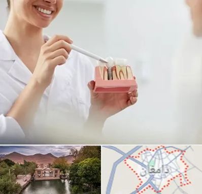 دکتر دندانساز در دامغان