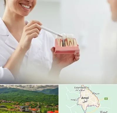 دکتر دندانساز در آمل