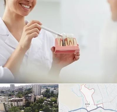 دکتر دندانساز در اوین