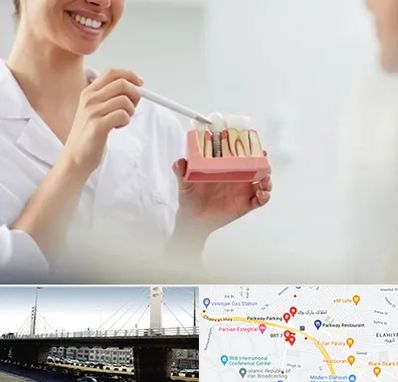 دکتر دندانساز در پارک وی 