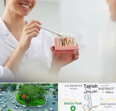 دکتر دندانساز در تجریش 