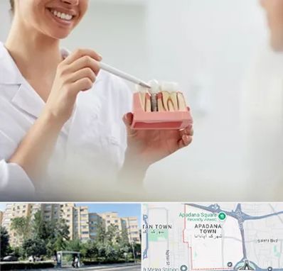 دکتر دندانساز در آپادانا