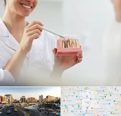 دکتر دندانساز در منطقه 7 تهران 