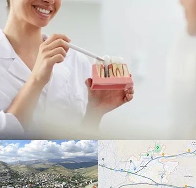 دکتر دندانساز در رودهن