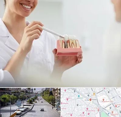 دکتر دندانساز در خیابان زند شیراز
