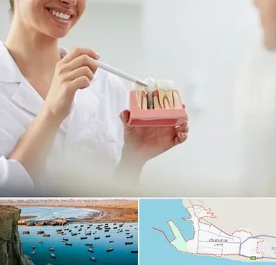 دکتر دندانساز در چابهار