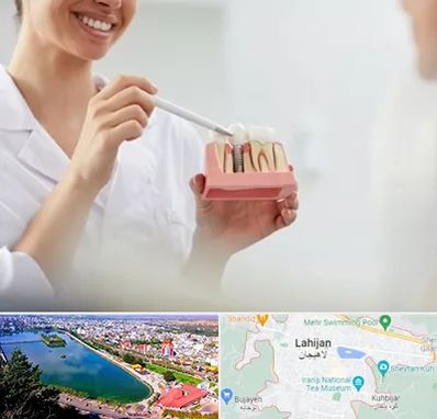 دکتر دندانساز در لاهیجان