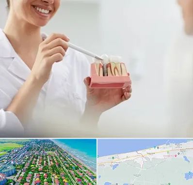 دکتر دندانساز در فریدونکنار