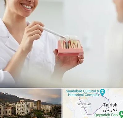 دکتر دندانساز در زعفرانیه 