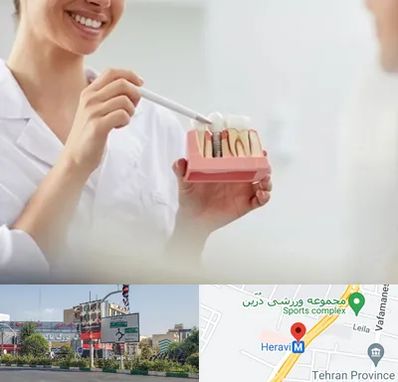 دکتر دندانساز در هروی 