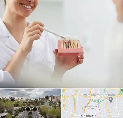 دکتر دندانساز در یوسف آباد 