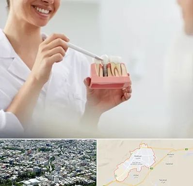 دکتر دندانساز در شاهرود