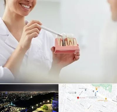 دکتر دندانساز در هفت تیر مشهد 