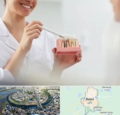 دکتر دندانساز در بابل