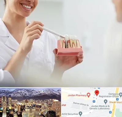 دکتر دندانساز در جردن 