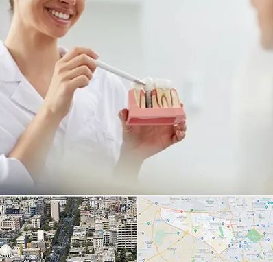 دکتر دندانساز در منطقه 18 تهران 