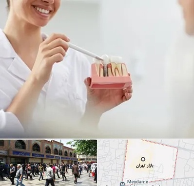 دکتر دندانساز در بازار تهران