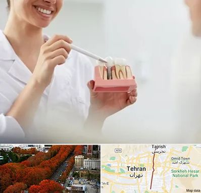 دکتر دندانساز در ولیعصر 