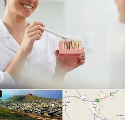 دکتر دندانساز در بیجار