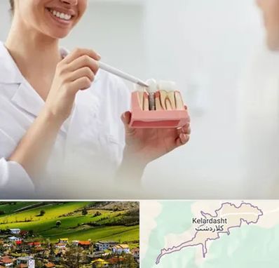 دکتر دندانساز در کلاردشت