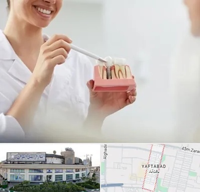 دکتر دندانساز در یافت آباد