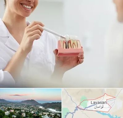 دکتر دندانساز در لواسان