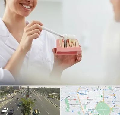 دکتر دندانساز در منطقه 17 تهران 