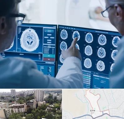 تصویر برداری شبانه روزی در اوین