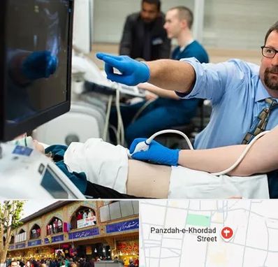 سونوگرافی شبانه روزی در 15 خرداد