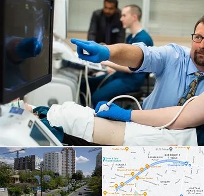 سونوگرافی شبانه روزی در اندرزگو 