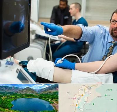 سونوگرافی شبانه روزی در رودبار