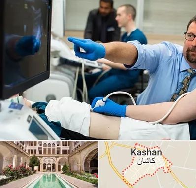 سونوگرافی شبانه روزی در کاشان