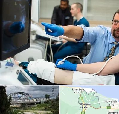 سونوگرافی شبانه روزی در چالوس