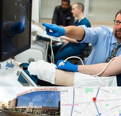 سونوگرافی شبانه روزی در نصف راه تبریز