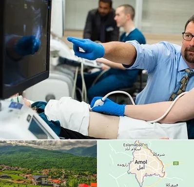 سونوگرافی شبانه روزی در آمل