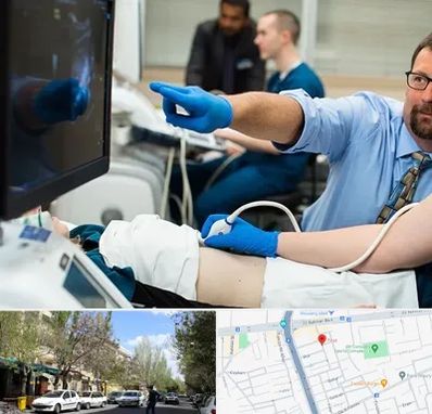 سونوگرافی شبانه روزی در کوی فیروز تبریز