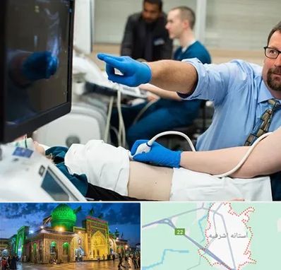 سونوگرافی شبانه روزی در آستانه اشرفیه