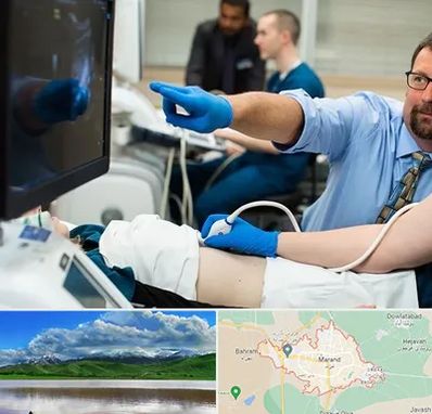 سونوگرافی شبانه روزی در مرند