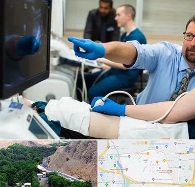 سونوگرافی شبانه روزی در کن 