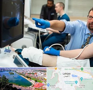 سونوگرافی شبانه روزی در لاهیجان