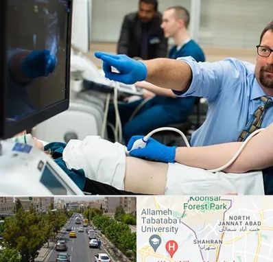 سونوگرافی شبانه روزی در شهران 