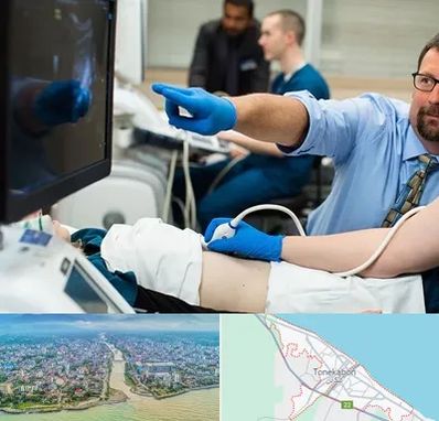 سونوگرافی شبانه روزی در تنکابن